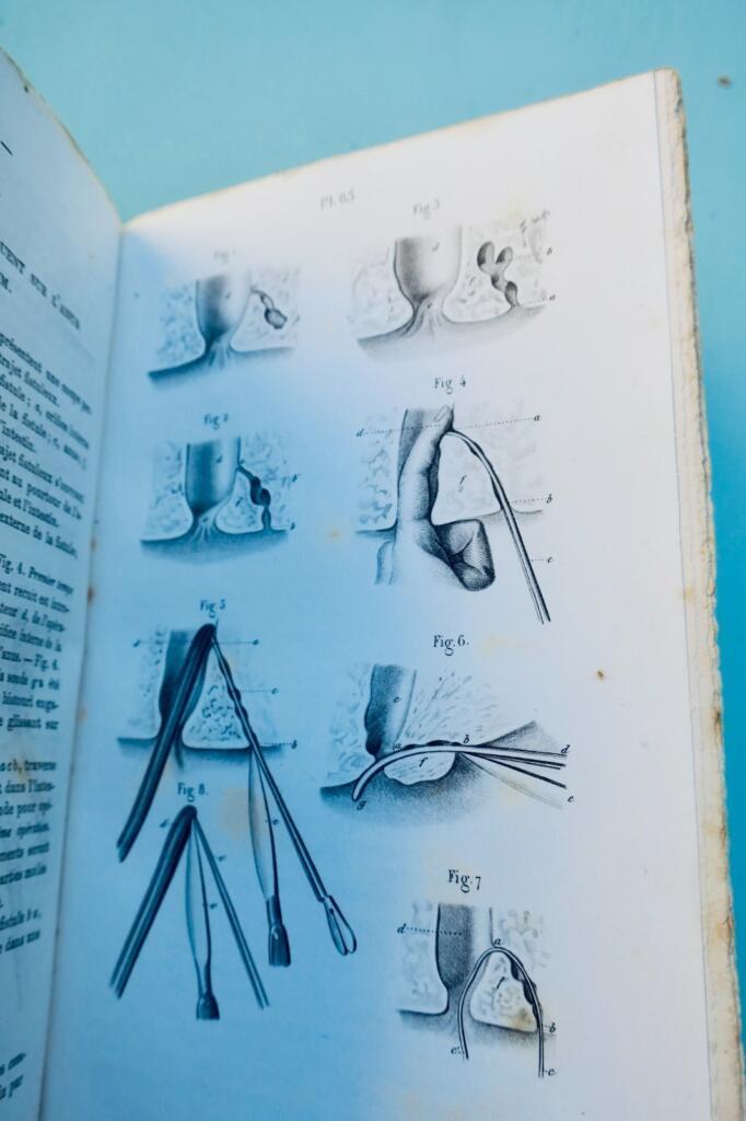 anatomie Bernard & Huette Précis iconographique de médecine opératoire 1846
