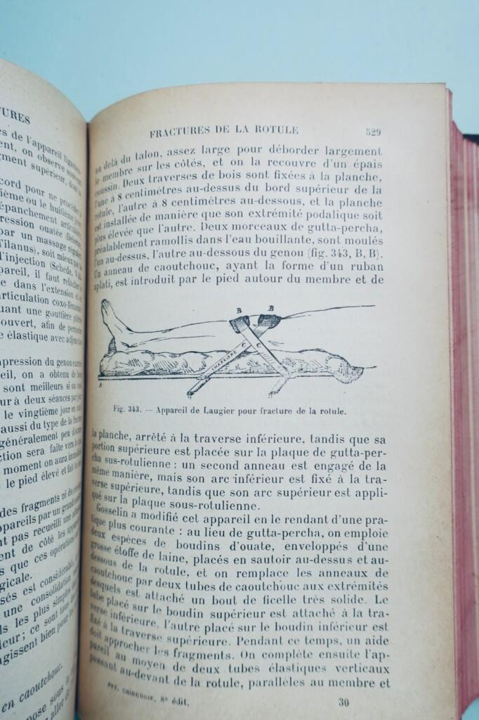 邦萨德·沙瓦斯《小外科要素：绷带、绷带法》1915年版