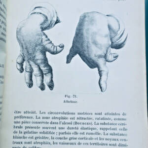 病理學 內科病理學精要 1914❦ pathologie PRECIS DE PATHOLOGIE INTERNE 1914