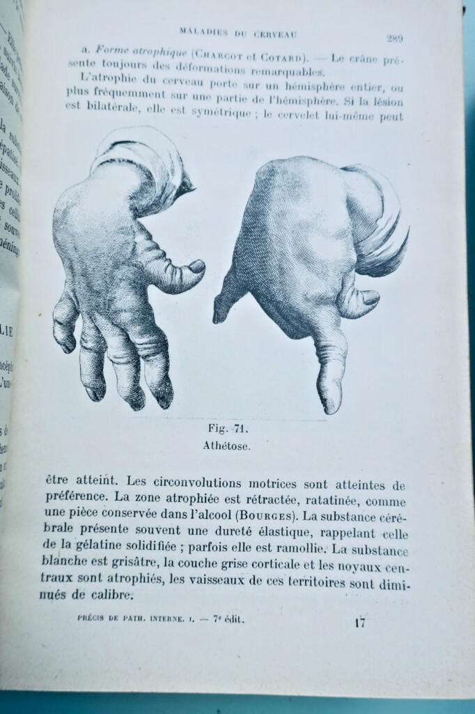 病理學 內科病理學精要 1914