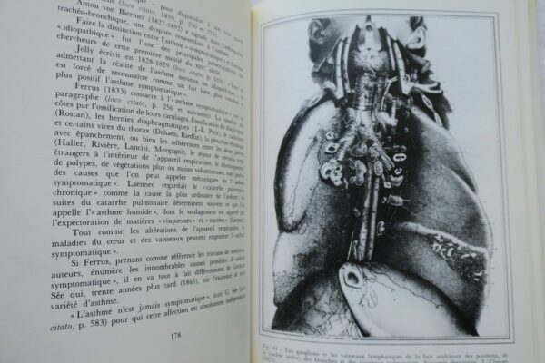 Asthme Histoire illustrée de l'asthme de l'Antiquité à nos jours – Image 5