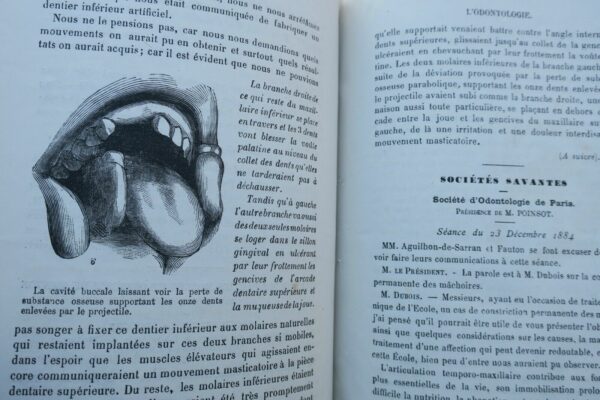 odontologie L'odontologie 1885 revue dentisterie