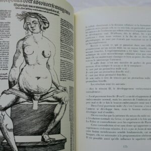 femme Histoire illustrée de la contraception