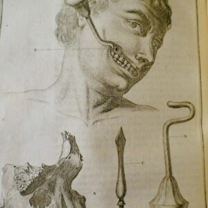 chirurgie Mémoires de l'Académie Royale de Chirurgie 1784