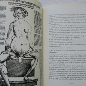 femme Histoire illustrée de la contraception