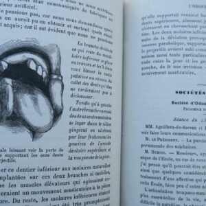 odontologie L'odontologie 1885 revue dentisterie